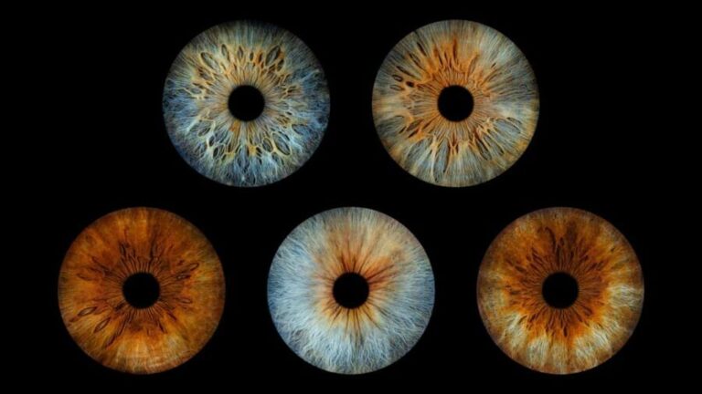 Paris Rivoli: Reveal the beauty of your iris with Iris Galerie - How Good Is the Value?